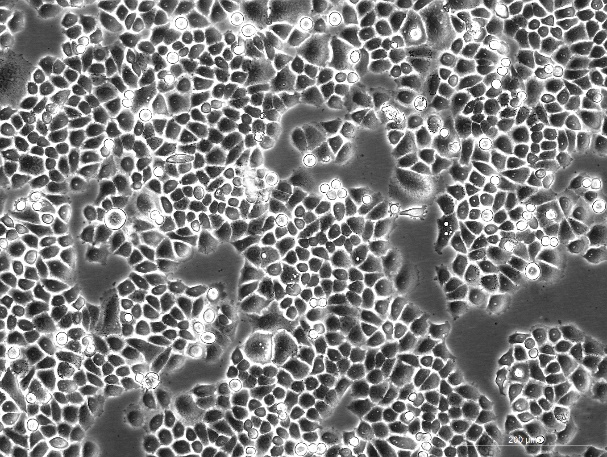 OriCell<sup>®</sup>SBC-2人小细胞肺癌细胞系