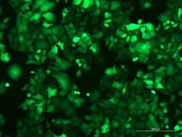 None OriCell<sup>®</sup>KYSE520 with Luciferase & GFP H1-3905