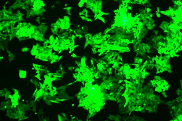 OriCell<sup>®</sup>NCI-H295R with GFP