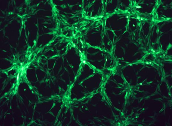 OriCell<sup>®</sup>U-87 MG with Luciferase & GFP