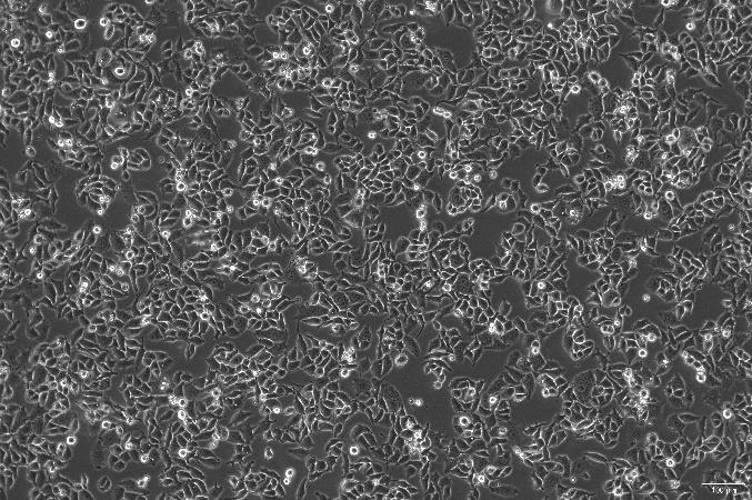 OriCell<sup>®</sup>RKO-E6 人结肠癌转基因 E6 细胞系