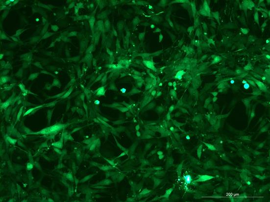 OriCell<sup>®</sup>5637 with GFP