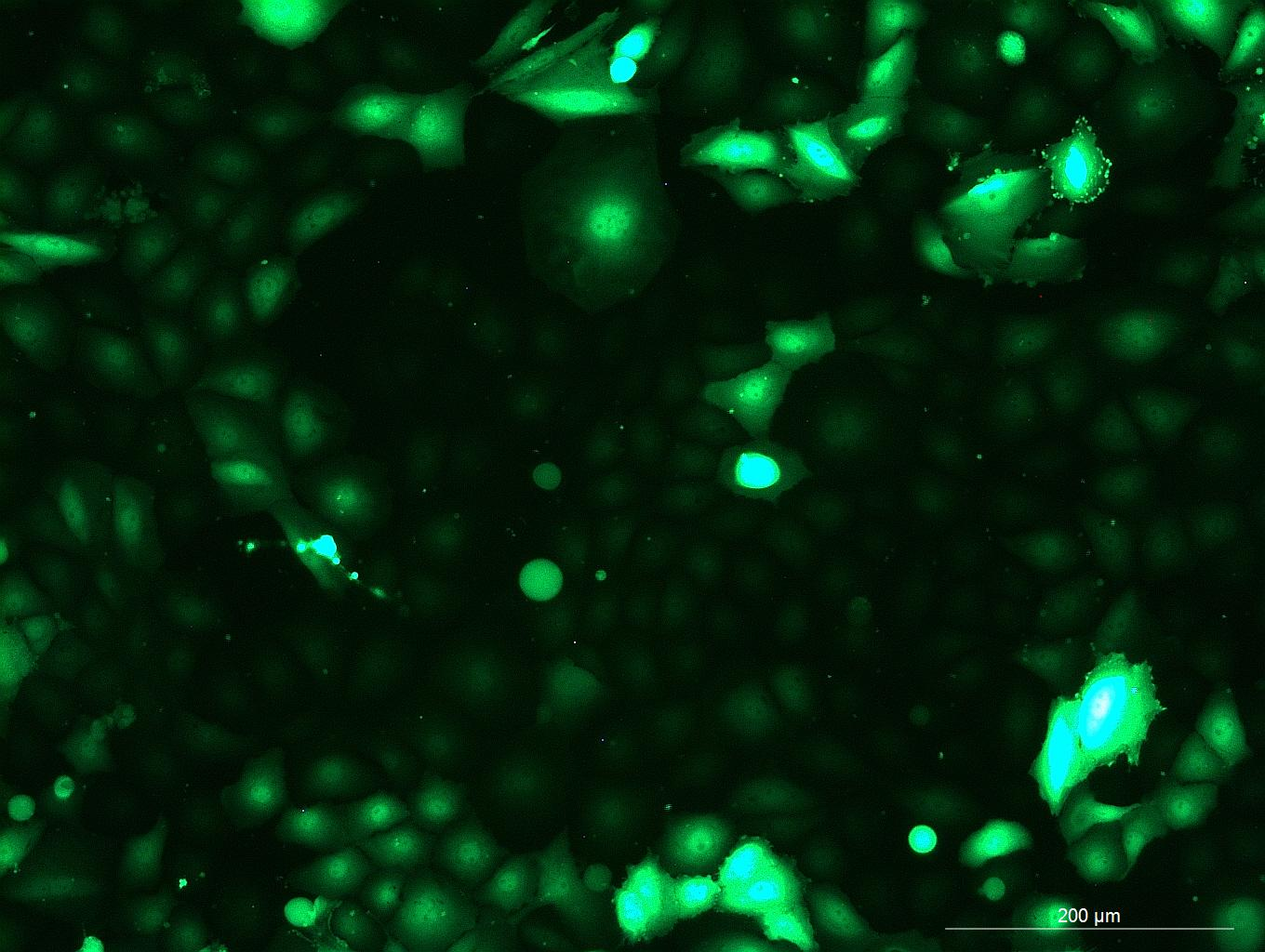 OriCell<sup>®</sup>NCI-H1650 with GFP