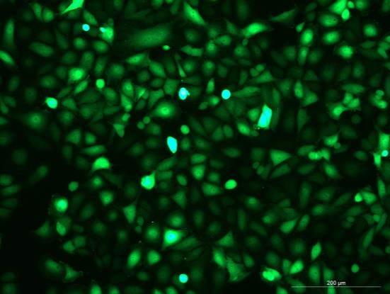 OriCell<sup>®</sup>T24 with Luciferase & GFP
