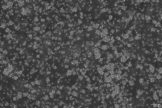 OriCell<sup>®</sup>SU-DHL-10 人 B 细胞淋巴瘤细胞系