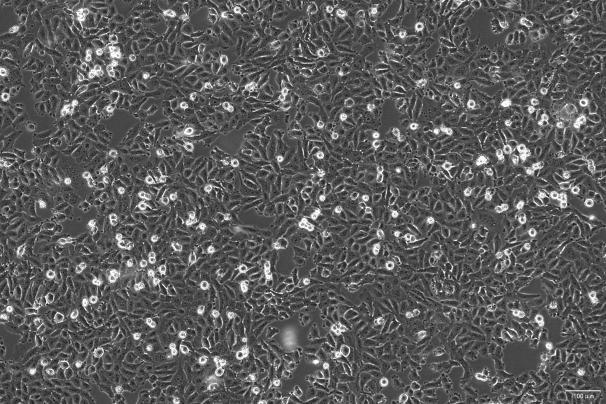 OriCell<sup>®</sup>PaTu8988t 人胰腺癌细胞系