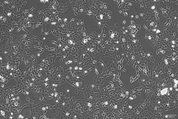 OriCell<sup>®</sup>OVCA-429 人卵巢癌细胞系