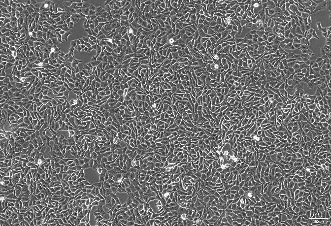 OriCell<sup>®</sup>SACC-83 人涎腺腺样囊性癌细胞系