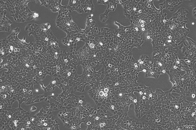 OriCell<sup>®</sup>TE-10 人食管癌细胞系