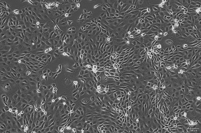 OriCell<sup>®</sup>SNU-216 人胃癌细胞系