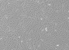 脂肪间充质干细胞(ADSC)