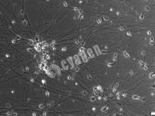 iPSC-CN（皮质神经元）
