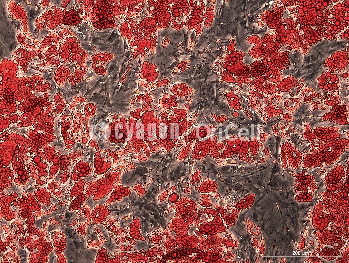 干细胞成脂诱导分化