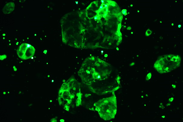 None OriCell<sup>®</sup>NCI-N87 with Luciferase & GFP H1-3805