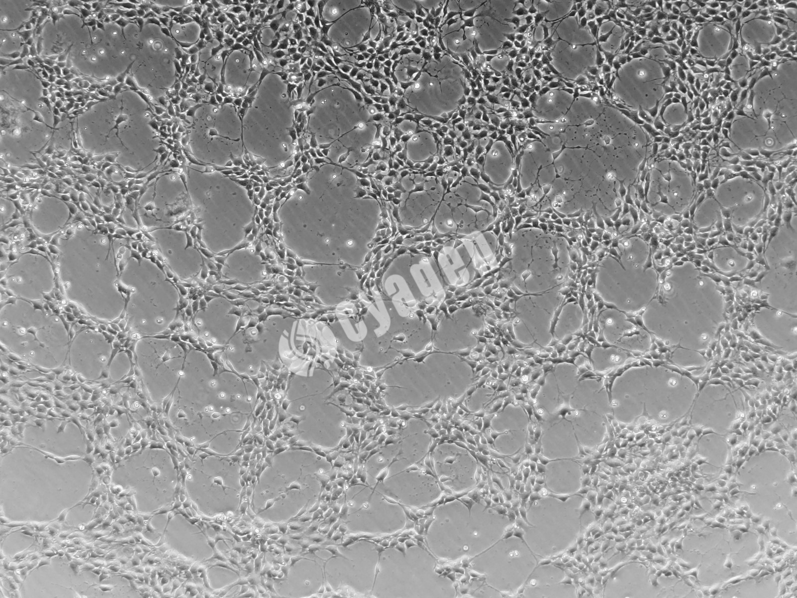 iPSC-NPC（神经祖细胞）