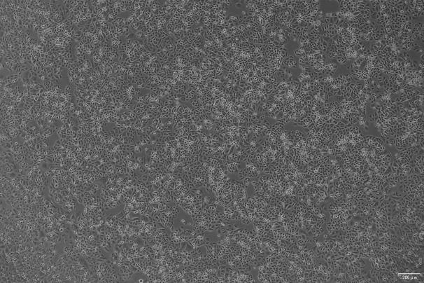 OriCell<sup>®</sup>G-401 人肾癌Wilms细胞系