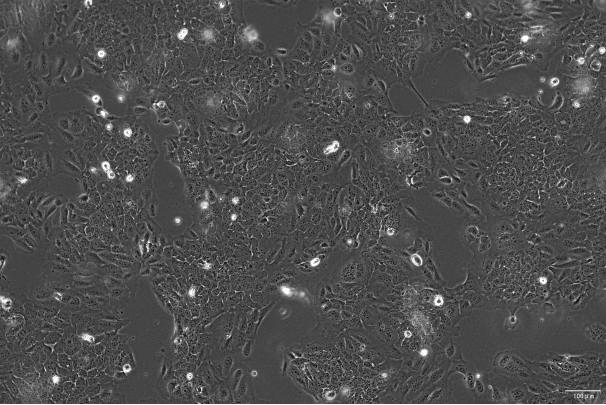 OriCell<sup>®</sup>SV-HUC-1 人输尿管上皮永生化细胞系