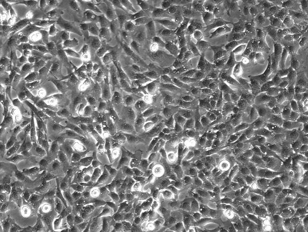 OriCell<sup>®</sup>T24 人膀胱移行细胞癌细胞系