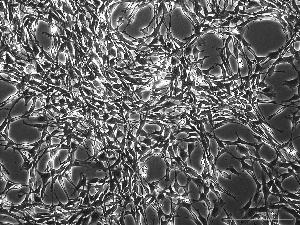 OriCell<sup>®</sup>YUMM1.7 小鼠黑色素瘤细胞系